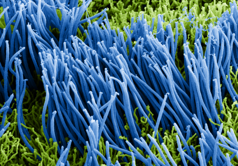 Agar Plates