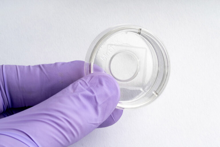 Agar Plates