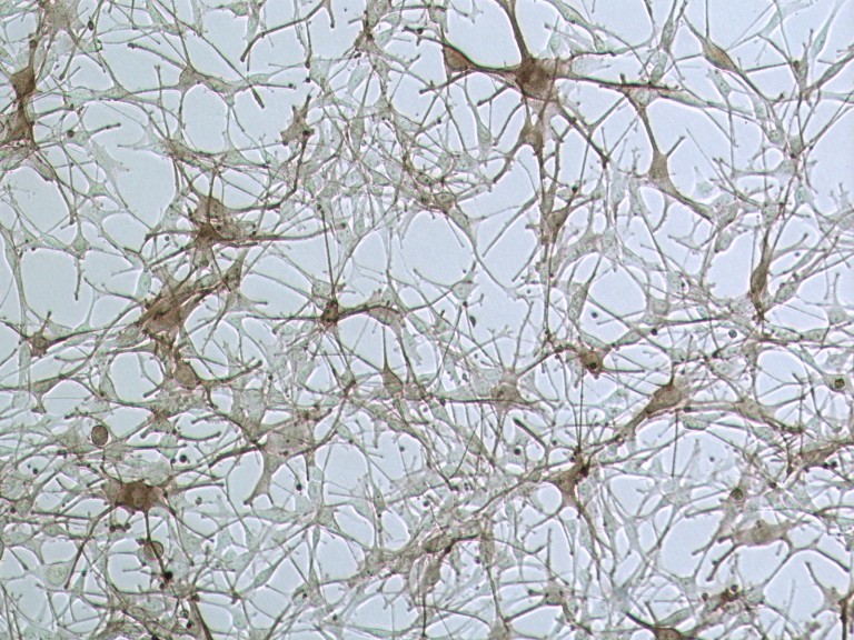 Agar Plates